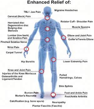 Chiropractic Saginaw MI Laser Relief